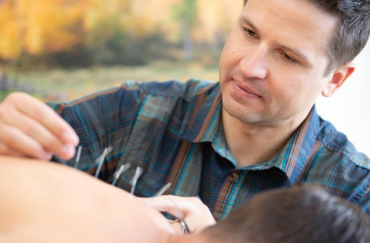 5 Reasons Why Acupuncture is Good for Reducing Workplace Stress